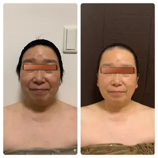 あるる所属・韓国式小顔矯正 担当ゆいのエステ・リラクイメージ