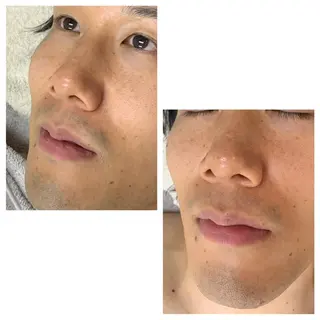 メンズ キッズ MISEREL岡崎店 Ayaのエステ・リラクイメージ