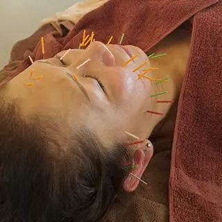 鍼灸サロンmiyabi所属・美容鍼×エステ　鍼灸 サロンmiyabiのエステ・リラクイメージ