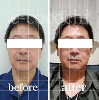 小顔と ヘッドスパのお店のエステ・リラクイメージ