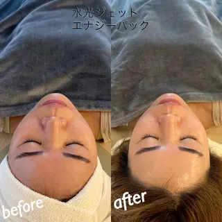 うなじ脱毛/美肌脱毛 LABELのエステ・リラクイメージ