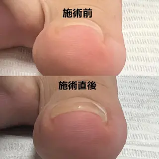 ネイル Gatto所属・Gatto(ガット) ヤマモトのネイルデザイン