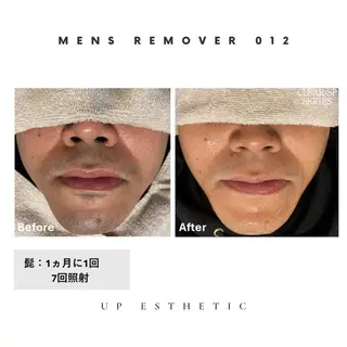 メンズ ウプエステティック所属・韓国肌管理 ウプエステティックのエステ・リラクイメージ