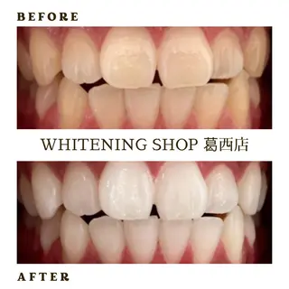 メンズ ホワイトニング ショップ葛西店のその他イメージ