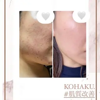 KOHAKU.所属・Nana Kikutaのエステ・リラクイメージ