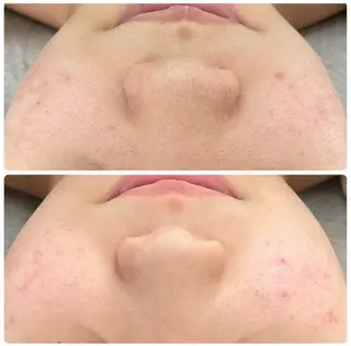 Esthe salon Blanche(エステサロンブランシュ)所属・小顔リフトアップ 美肌改善専門店のエステ・リラクイメージ