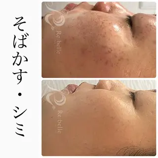 ハーブピーリング専門 BIOEL横浜のエステ・リラクイメージ