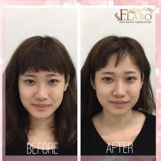 小顔&ダイエットジム エステ担当REIKOのその他イメージ