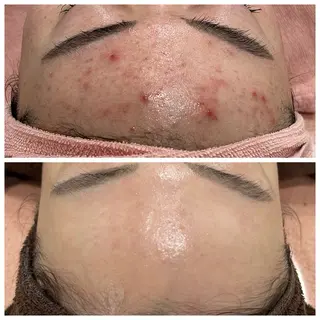 【現役看護師】高来 笑子のエステ・リラクイメージ