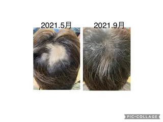 頭髪学院所属・髪の毛増やしま専科 頭髪学院のその他イメージ