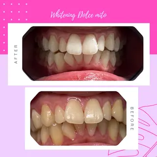 セルフホワイトニング Dolce水戸店のその他イメージ