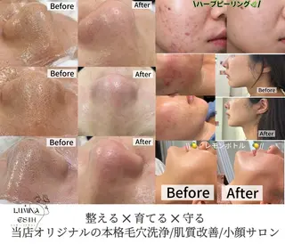 LUMINAESTH所属・LUMINA ESTHのエステ・リラクイメージ