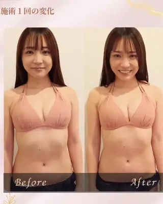 マシュマロバスト coucouのエステ・リラクイメージ