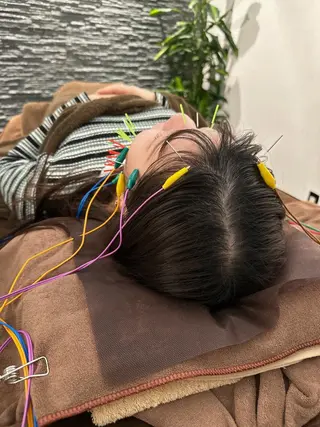 美容鍼灸整体サロンBeauJu所属・小顔矯/美容鍼/鍼灸 BeauJuのその他イメージ