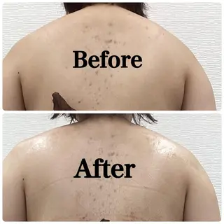 パーソナルエステ L'purのエステ・リラクイメージ