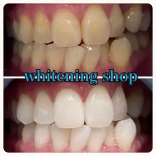 ホワイトニング ショップ吉祥寺店のエステ・リラクイメージ