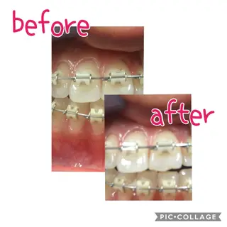 self whitening  BIOLUS所属・whitening BIOLUSのその他イメージ