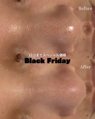 BELLIS HUIT所属・ハーブピーリング那覇 BELLISHUITのエステ・リラクイメージ