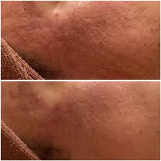 ニキビ・肌質改善専門 ♡人生が変わるサロンのエステ・リラクイメージ