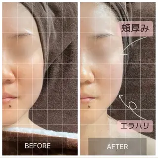 MIRAI小顔 錦糸町店のエステ・リラクイメージ