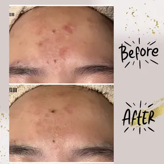 ピーリング専門店 Belluteのエステ・リラクイメージ