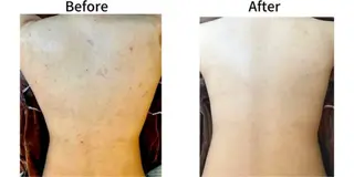 脱毛&フェイシャル 専門店muro.のエステ・リラクイメージ