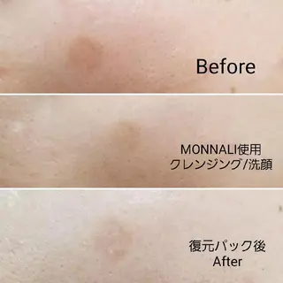 Anacia Beauty Salon所属・美肌脱毛&毛穴専門 Anaciaのエステ・リラクイメージ