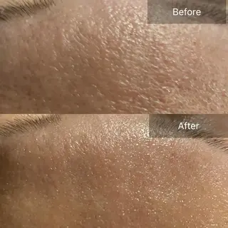 Mandarin Orange所属・毛穴から始める肌メン テマンダリンオレンジのエステ・リラクイメージ