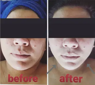 【 Laforme】 ラ・フォルムのエステ・リラクイメージ