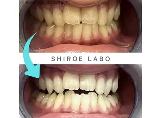 【歯のホワイトニング専門店】シロエラボ梅田店所属・シロエラボ 梅田店のその他イメージ