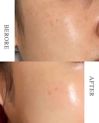 エステサロン イデアルMe大宮店所属・イデアルMe♡ KIMISHIMAのその他イメージ