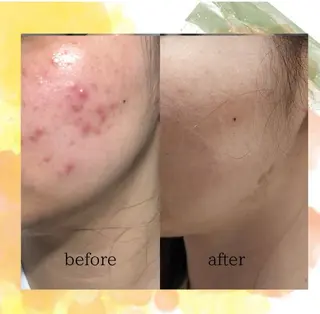 痩身専門サロン マハロミのエステ・リラクイメージ