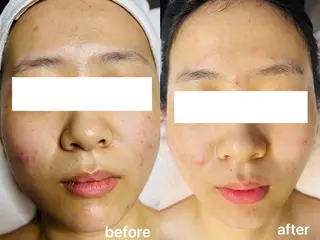 Beauty Zion所属・Beauty Zionのエステ・リラクイメージ