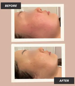 AY'S所属・倉敷/玉島/毛穴洗浄 古川碧のエステ・リラクイメージ