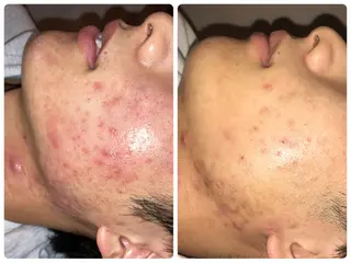 BIB PIBのエステ・リラクイメージ