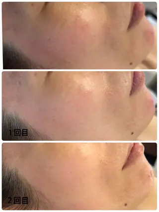 美ola ビオラのエステ・リラクイメージ