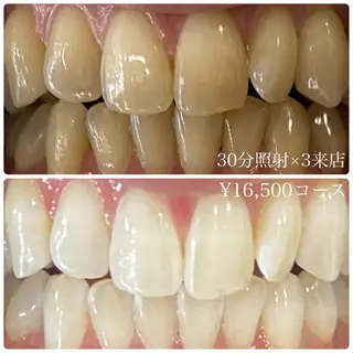 メンズ ホワイトニングルーム　川崎店所属・ホワイトニング ルーム　川崎店のその他イメージ