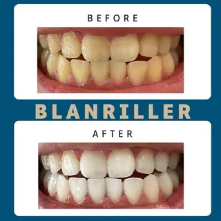 BLANRILLER所属・ホワイトニングサロン ブランリエ阿倍野店のその他イメージ