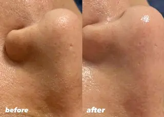 高評価多💞マツエク /マツパ/眉毛梅田のマツエク・マツパデザイン