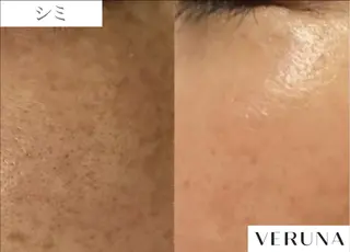 業界初の頭皮ケア 棘スカルプLUNEAのヘアスタイル