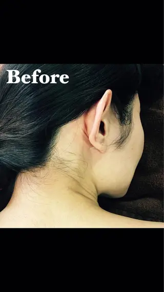 MIMI 吉祥寺本店のエステ・リラクイメージ