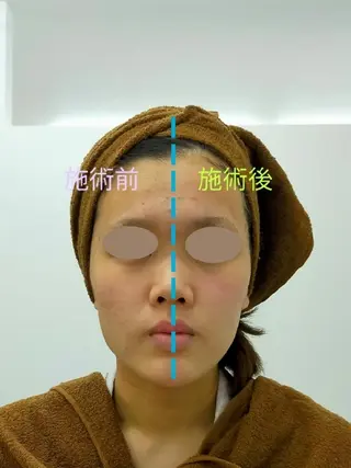 CORAL湘南平塚店所属・【小顔・美容専門】 🐠リカのエステ・リラクイメージ