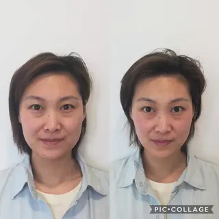 ショート 小顔矯正/美容整体 /骨盤矯正✨+Mi2のエステ・リラクイメージ