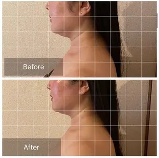 表情筋フェイシャル 三軒茶屋のエステ・リラクイメージ