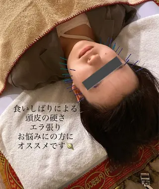 美容鍼/ヘッドスパ/ 💎さかもとのエステ・リラクイメージ