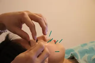 limahoola 鍼灸整骨院のエステ・リラクイメージ