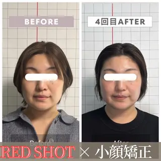 小顔矯正専門店 【RED】池田のエステ・リラクイメージ
