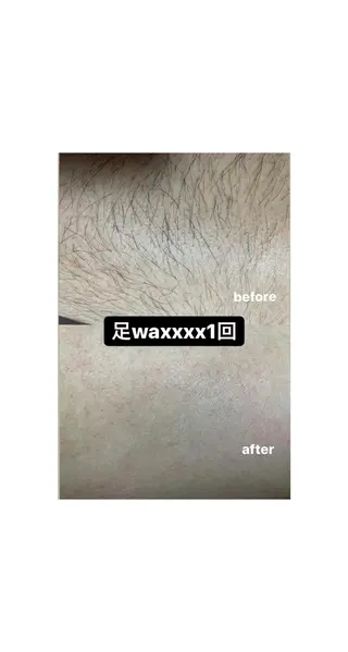 Epina 千葉店 【エピナ】のエステ・リラクイメージ