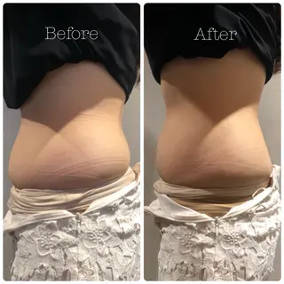 姿勢改善&beauty salon LAUB所属・姿勢改善 サロンLAUB奥村のエステ・リラクイメージ