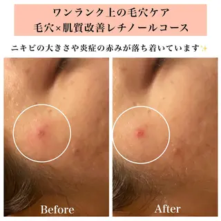 Bellesthe （ベルエステ）のエステ・リラクイメージ